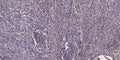 Palladin rabbit pAb – Figure 1 of 1