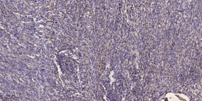 Palladin rabbit pAb – Figure 1 of 1