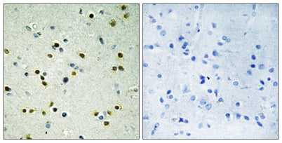 JMJD2B rabbit pAb – Figure 1 of 1