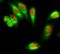 Immunofluorescence analysis of Hela cell. 1,FoxO1 Polyclonal Antibody(red) was diluted at 1:200(4° overnight). CK7 Monoclonal Antibody(12D7)(green) was diluted at 1:200(4° overnight). 2, Goat Anti Rabbit Alexa Fluor 594 Catalog:RS3611 was diluted at 1:1000(room temperature, 50min). Goat Anti Mouse Alexa Fluor 488 Catalog:RS3208  was diluted at 1:1000(room temperature, 50min).
