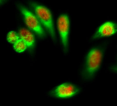 Immunofluorescence analysis of Hela cell. 1,FoxO1 Polyclonal Antibody(red) was diluted at 1:200(4° overnight). CK7 Monoclonal Antibody(12D7)(green) was diluted at 1:200(4° overnight). 2, Goat Anti Rabbit Alexa Fluor 594 Catalog:RS3611 was diluted at 1:1000(room temperature, 50min). Goat Anti Mouse Alexa Fluor 488 Catalog:RS3208  was diluted at 1:1000(room temperature, 50min).