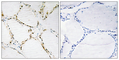 Immunohistochemistry analysis of paraffin-embedded human thyroid gland tissue, using FOXO1A/3A Antibody. The picture on the right is blocked with the synthesized peptide.