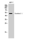 Western Blot analysis of MCF-7 cells using Cerebral 1 Polyclonal Antibody cells nucleus extracted by Minute TM Cytoplasmic and Nuclear Fractionation kit (SC-003,Inventbiotech,MN,USA).