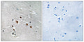 Immunohistochemistry analysis of paraffin-embedded human brain tissue, using MED13L Antibody. The picture on the right is blocked with the synthesized peptide.