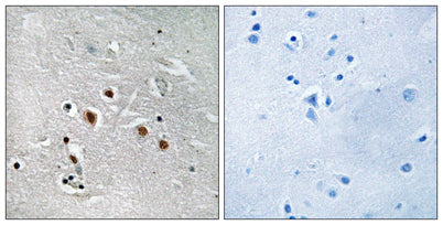 Immunohistochemistry analysis of paraffin-embedded human brain tissue, using MED13L Antibody. The picture on the right is blocked with the synthesized peptide.