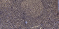 Immunohistochemical analysis of paraffin-embedded human tonsil. 1, Antibody was diluted at 1:200(4° overnight). 2, Tris-EDTA,pH9.0 was used for antigen retrieval. 3,Secondary antibody was diluted at 1:200(room temperature, 45min).