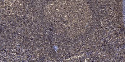 Immunohistochemical analysis of paraffin-embedded human tonsil. 1, Antibody was diluted at 1:200(4° overnight). 2, Tris-EDTA,pH9.0 was used for antigen retrieval. 3,Secondary antibody was diluted at 1:200(room temperature, 45min).