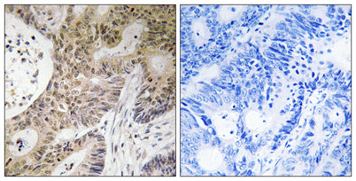 PRP6 rabbit pAb – Figure 1 of 1
