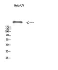 Western Blot analysis of hela-UV using Antibody diluted at 1:1000. Secondary antibody(catalog#:RS0002) was diluted at 1:20000