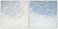 GABAA Rβ2 rabbit pAb – Figure 1 of 2
