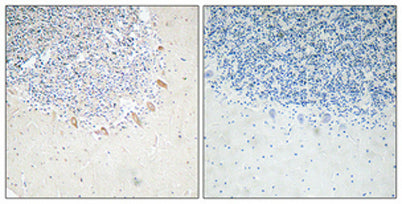 GABAA Rβ2 rabbit pAb – Figure 1 of 2