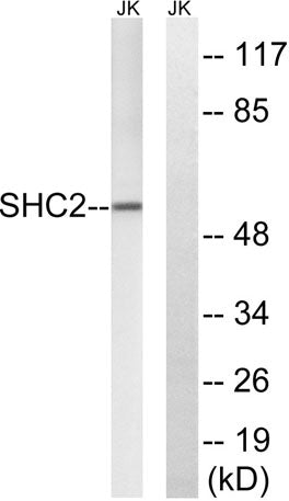 Western blot analysis of lysates from Jurkat cells, using SHC2 Antibody. The lane on the right is blocked with the synthesized peptide.