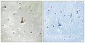 LRP10 rabbit pAb – Figure 1 of 1