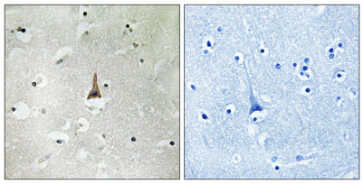 LRP10 rabbit pAb – Figure 1 of 1