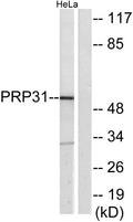 PRPF31 rabbit pAb – Figure 1 of 2