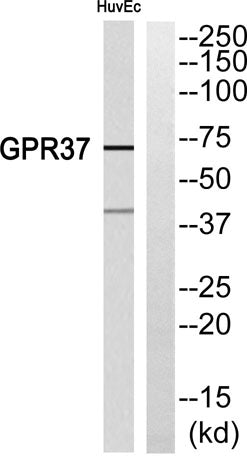 Western blot analysis of GPR37 Antibody. The lane on the right is blocked with the GPR37 peptide.