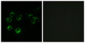 Immunofluorescence analysis of MCF-7 cells, using GPR42 Antibody. The picture on the right is blocked with the synthesized peptide.