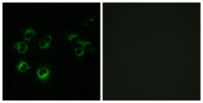 Immunofluorescence analysis of MCF-7 cells, using GPR42 Antibody. The picture on the right is blocked with the synthesized peptide.