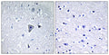 mGluR1 rabbit pAb – Figure 1 of 1
