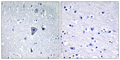 mGluR1 rabbit pAb – Figure 1 of 1