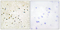 Immunohistochemistry analysis of paraffin-embedded human brain tissue, using TF2H1 Antibody. The picture on the right is blocked with the synthesized peptide.