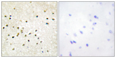 Immunohistochemistry analysis of paraffin-embedded human brain tissue, using TF2H1 Antibody. The picture on the right is blocked with the synthesized peptide.