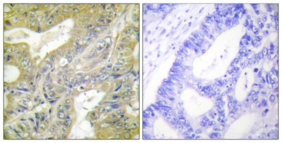 Hexb rabbit pAb – Figure 1 of 2