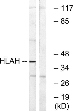 Western blot analysis of lysates from LOVO cells, using HLAH Antibody. The lane on the right is blocked with the synthesized peptide.