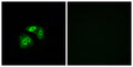 Immunofluorescence analysis of A549 cells, using VN1R5 Antibody. The picture on the right is blocked with the synthesized peptide.