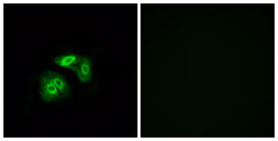 Immunofluorescence analysis of A549 cells, using VN1R5 Antibody. The picture on the right is blocked with the synthesized peptide.