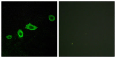 Immunofluorescence analysis of LOVO cells, using HTR5A Antibody. The picture on the right is blocked with the synthesized peptide.