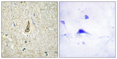 CYP26C1 rabbit pAb – Figure 1 of 2
