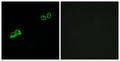Immunofluorescence analysis of MCF7 cells, using OR2AT4 Antibody. The picture on the right is blocked with the synthesized peptide.
