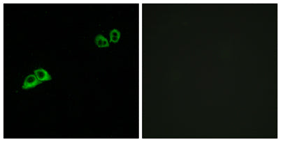 Immunofluorescence analysis of MCF7 cells, using OR2AT4 Antibody. The picture on the right is blocked with the synthesized peptide.