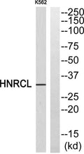 Western blot analysis of HNRCL Antibody. The lane on the right is blocked with the HNRCL peptide.