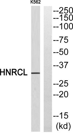 Western blot analysis of HNRCL Antibody. The lane on the right is blocked with the HNRCL peptide.