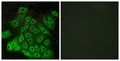 Immunofluorescence analysis of A549 cells, using CSRL1 Antibody. The picture on the right is blocked with the synthesized peptide.