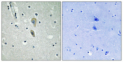 IL-1RI (phospho Tyr496) rabbit pAb – Figure 1 of 1
