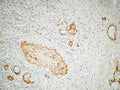 Immunohistochemical analysis of paraffin-embedded Human ovary. 1, Antibody was diluted at 1:200(4° overnight).  2, High-pressure and temperature EDTA, pH8.0 was used for antigen retrieval. 3,Secondary antibody was diluted at 1:200(room temperature, 30min).