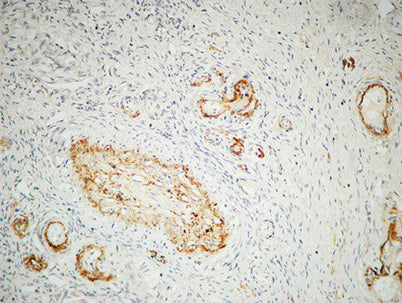 Immunohistochemical analysis of paraffin-embedded Human ovary. 1, Antibody was diluted at 1:200(4° overnight).  2, High-pressure and temperature EDTA, pH8.0 was used for antigen retrieval. 3,Secondary antibody was diluted at 1:200(room temperature, 30min).