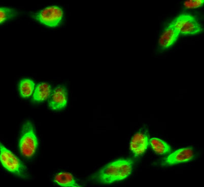 Immunofluorescence analysis of Hela cell. 1,IRF-3 (phospho Ser385) Polyclonal Antibody(red) was diluted at 1:200(4° overnight). COX IV Monoclonal Antibody(6C8)(green) was diluted at 1:200(4° overnight). 2, Goat Anti Rabbit Alexa Fluor 594 Catalog:RS3611 was diluted at 1:1000(room temperature, 50min). Goat Anti Mouse Alexa Fluor 488 Catalog:RS3208  was diluted at 1:1000(room temperature, 50min).
