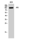 AR rabbit pAb – Figure 1 of 3