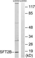 Western blot analysis of lysates from LOVO cells, using SFT2B Antibody. The lane on the right is blocked with the synthesized peptide.