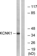 Western blot analysis of lysates from Jurkat cells, using KCNK1 Antibody. The lane on the right is blocked with the synthesized peptide.