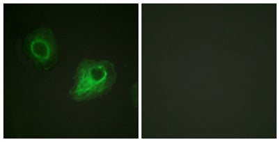 Immunofluorescence analysis of HeLa cells, using VEGFR2 Antibody. The picture on the right is blocked with the synthesized peptide.