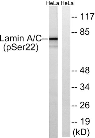 Lamin A/C (phospho Ser22) rabbit pAb – Figure 1 of 2