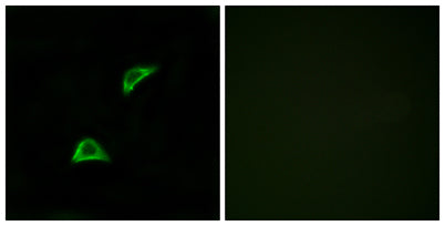 Immunofluorescence analysis of LOVO cells, using OR51A4 Antibody. The picture on the right is blocked with the synthesized peptide.