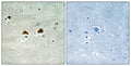 MAP-4 (phospho Ser696) rabbit pAb – Figure 1 of 2