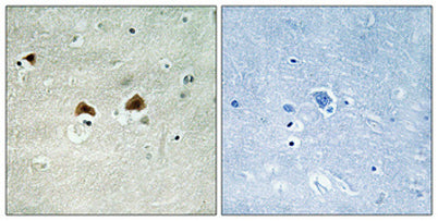 MAP-4 (phospho Ser696) rabbit pAb – Figure 1 of 2