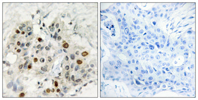 AF-4 rabbit pAb – Figure 1 of 1